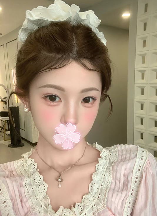 ノーイメージ